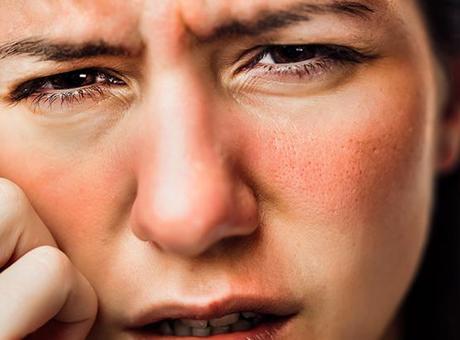 Yüzdeki ani kızarıklığa dikkat! Gül hastalığı sessizce ilerleyebilir